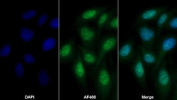 Invitrogen Factor V Polyclonal Antibody:Antibodies:Primary Antibodies