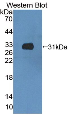 Invitrogen CCDC60 Polyclonal Antibody 20 &mu;L; Unconjugated:Antibodies,