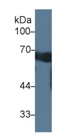 Invitrogen CCDC60 Polyclonal Antibody:Antibodies:Primary Antibodies