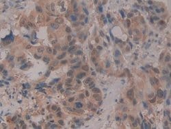 Invitrogen CIRBP Polyclonal Antibody:Antibodies:Primary Antibodies