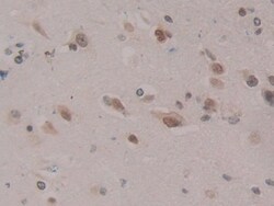Invitrogen CIRBP Polyclonal Antibody:Antibodies:Primary Antibodies