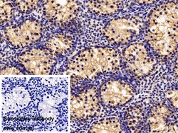 Invitrogen CIRBP Polyclonal Antibody:Antibodies:Primary Antibodies