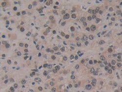 Invitrogen CIRBP Polyclonal Antibody:Antibodies:Primary Antibodies
