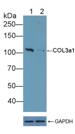 Invitrogen Collagen III Polyclonal Antibody:Antibodies:Primary Antibodies