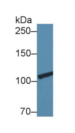 Invitrogen Collagen III Polyclonal Antibody:Antibodies:Primary Antibodies