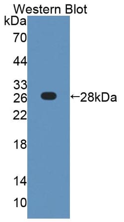 Invitrogen COL4A4 Polyclonal Antibody:Antibodies:Primary Antibodies