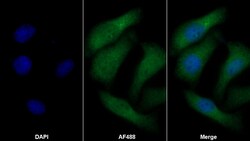 Invitrogen COL4A5 Polyclonal Antibody:Antibodies:Primary Antibodies
