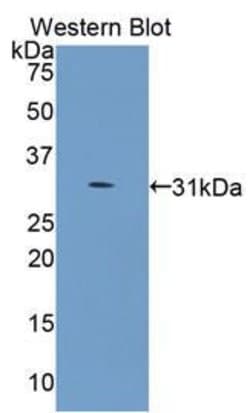 COL4A5 Polyclonal Antibody, Invitrogen 20 &mu;L; Unconjugated:Antibodies,