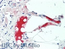Invitrogen Complement C4b Polyclonal Antibody 20 &mu;L; Unconjugated:Antibodies,
