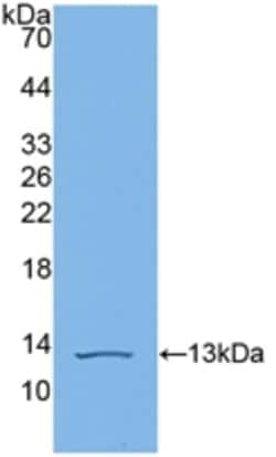 Invitrogen Complement C4b Polyclonal Antibody 20 &mu;L; Unconjugated:Antibodies,