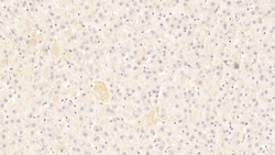 Invitrogen Complement C4b Polyclonal Antibody 20 &mu;L; Unconjugated:Antibodies,