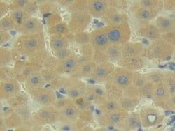 Invitrogen C2 Polyclonal Antibody 200 &mu;L; Unconjugated:Antibodies, Polyclonal