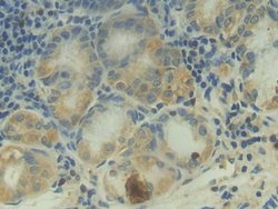 Invitrogen C2 Polyclonal Antibody 200 &mu;L; Unconjugated:Antibodies, Polyclonal