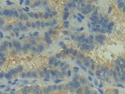 Invitrogen C2 Polyclonal Antibody 200 &mu;L; Unconjugated:Antibodies, Polyclonal