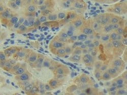 Invitrogen C2 Polyclonal Antibody 200 &mu;L; Unconjugated:Antibodies, Polyclonal