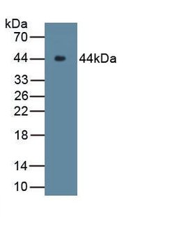 Invitrogen Complement C9 Polyclonal Antibody 20 &mu;L; Unconjugated:Antibodies,