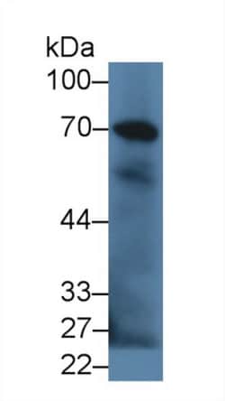 Invitrogen Complement C9 Polyclonal Antibody 20 &mu;L; Unconjugated:Antibodies,