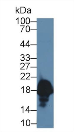 Invitrogen CPLX1 Polyclonal Antibody 200 &mu;L; Unconjugated:Antibodies,