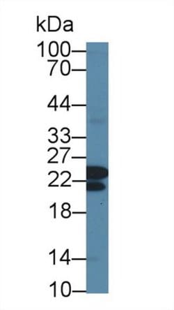 Invitrogen CBF beta Polyclonal Antibody 200 &mu;L; Unconjugated:Antibodies,