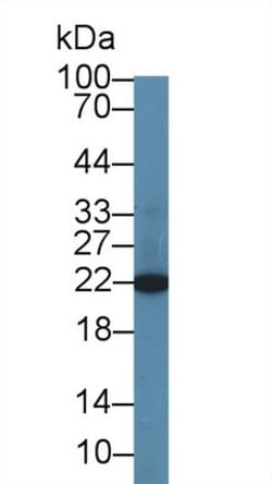 Invitrogen CBF beta Polyclonal Antibody 200 &mu;L; Unconjugated:Antibodies,