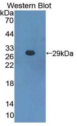 Invitrogen CBF beta Polyclonal Antibody 200 &mu;L; Unconjugated:Antibodies,
