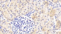 Invitrogen SERPINA6 Polyclonal Antibody:Antibodies:Primary Antibodies