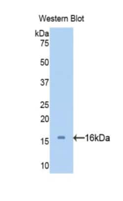 Invitrogen SERPINA6 Polyclonal Antibody 200 &mu;L; Unconjugated:Antibodies,