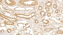 Invitrogen beta L Crystallin Polyclonal Antibody:Antibodies:Primary Antibodies