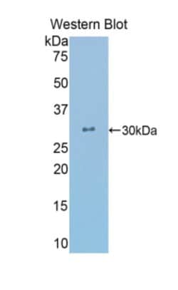 Invitrogen beta L Crystallin Polyclonal Antibody:Antibodies:Primary Antibodies
