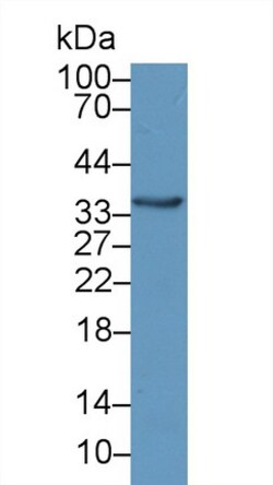 Invitrogen beta L Crystallin Polyclonal Antibody 20 &mu;L; Unconjugated:Antibodies,