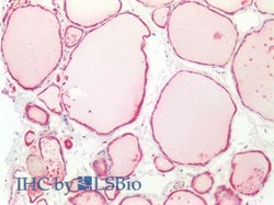 Invitrogen DCL-1 Polyclonal Antibody:Antibodies:Primary Antibodies