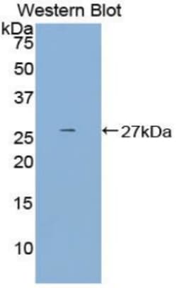 Invitrogen DCL-1 Polyclonal Antibody:Antibodies:Primary Antibodies