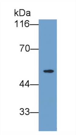 Invitrogen Cyclin B1 Polyclonal Antibody:Antibodies:Primary Antibodies