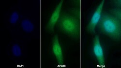 Invitrogen Cyclin D1 Polyclonal Antibody 200 &mu;L | Buy Online | Invitrogen&trade; | Fisher Scientific