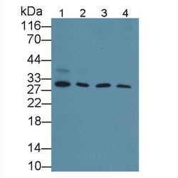 Invitrogen Cyclin D1 Polyclonal Antibody 200 &mu;L | Buy Online | Invitrogen&trade; | Fisher Scientific