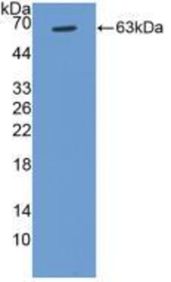 Invitrogen Cyclin D1 Polyclonal Antibody:Antibodies:Primary Antibodies