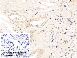 Invitrogen CDK4 Polyclonal Antibody 200 &mu;L | Buy Online | Invitrogen&trade; | Fisher Scientific