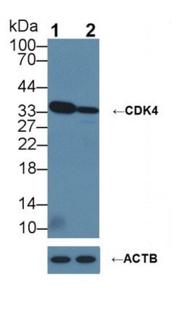 Invitrogen CDK4 Polyclonal Antibody 200 &mu;L | Buy Online | Invitrogen&trade; | Fisher Scientific