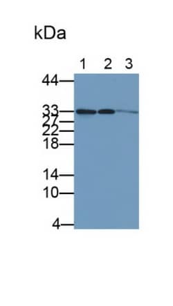 Invitrogen CDK4 Polyclonal Antibody 200 &mu;L | Buy Online | Invitrogen&trade; | Fisher Scientific