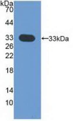 Invitrogen CDK4 Polyclonal Antibody 200 &mu;L | Buy Online | Invitrogen&trade; | Fisher Scientific