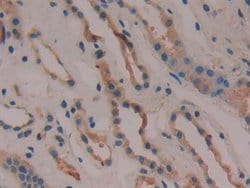 Invitrogen COX2 Polyclonal Antibody:Antibodies:Primary Antibodies