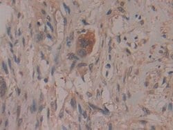 Invitrogen COX2 Polyclonal Antibody:Antibodies:Primary Antibodies