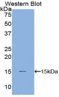 Invitrogen Cystatin B Polyclonal Antibody 20 &mu;L; Unconjugated:Antibodies,