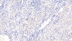 Invitrogen CSRP1 Polyclonal Antibody 200 &mu;L | Buy Online | Invitrogen&trade; | Fisher Scientific