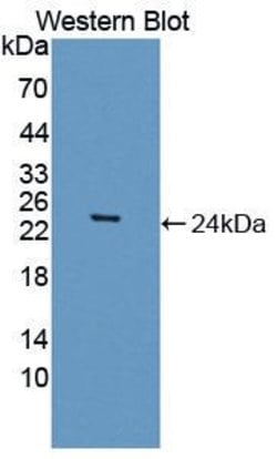 Invitrogen CSRP1 Polyclonal Antibody 200 &mu;L | Buy Online | Invitrogen&trade; | Fisher Scientific