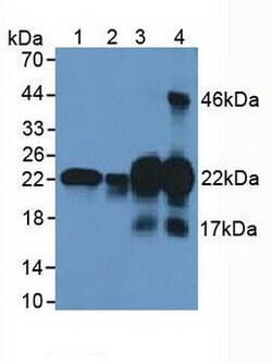 Invitrogen CSRP1 Polyclonal Antibody 200 &mu;L | Buy Online | Invitrogen&trade; | Fisher Scientific