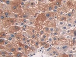 Invitrogen CYP26A1 Polyclonal Antibody 200 &mu;L; Unconjugated:Antibodies,