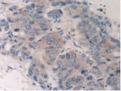 Invitrogen CYP26A1 Polyclonal Antibody 200 &mu;L; Unconjugated:Antibodies,