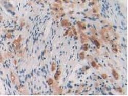 Invitrogen CYP26A1 Polyclonal Antibody 200 &mu;L; Unconjugated:Antibodies,