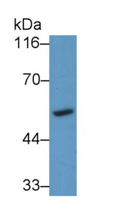 Invitrogen CYP26A1 Polyclonal Antibody:Antibodies:Primary Antibodies